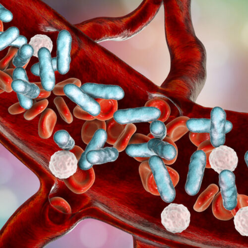 Sepsis, bacteria in blood. 3D illustration showing rod-shaped bacteria with red blood cells and leukocytes